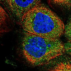 ZSWIM6 Antibody, Novus Biologicals 25 &mu;L, Unlabeled:Antibodies, Polyclonal